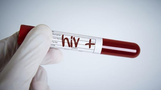Coraz więcej przypadków HIV w Polsce. W większości nie wiadomo, jak doszło do zakażenia