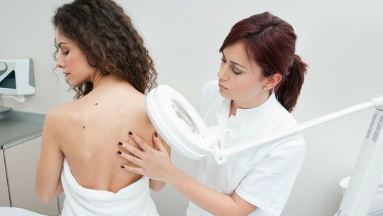 Pieprzyki i znamiona. Badaj je regularnie