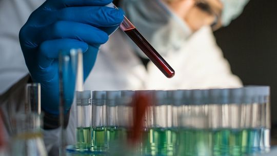 Problemy z pamięcią i zmęczenie. Naukowcy odkryli, co może odpowiadać za long covid