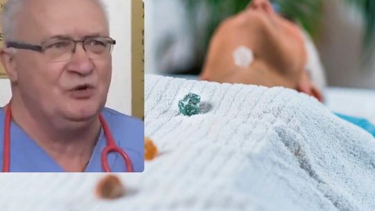 Prof. Simon ostrzega przed „leczeniem”, które może szkodzić. „Szarlatani żerują na pacjentach”