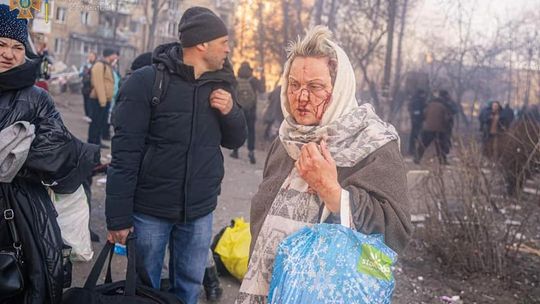 Putin przekroczył w Ukrainie nie jedną granicę. Używa broni, która spala człowieka